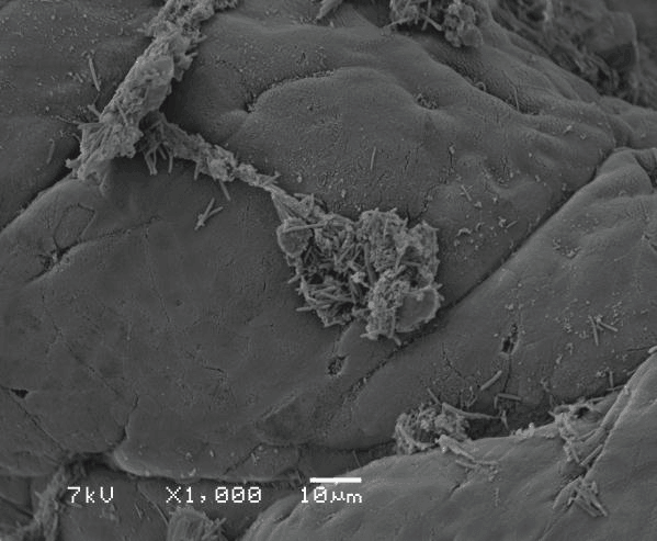 تصویر میکروسکوپ الکترونی از اثر حضور مخمر اتولیز شده بر کاهش جمعیت پاتوژن های سلول های پوششی روده ای
